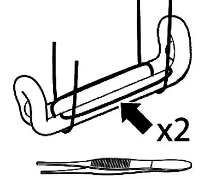 AtriCure ACH135 AtriClip LAA Exclusion System - After the Clip is deployed, remove the attachment sutures by gently pulling
