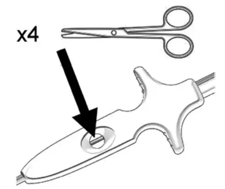 AtriCure ACH135 AtriClip LAA Exclusion System - Deploy the Clip by manually cutting the suture at the designated cutting zone
