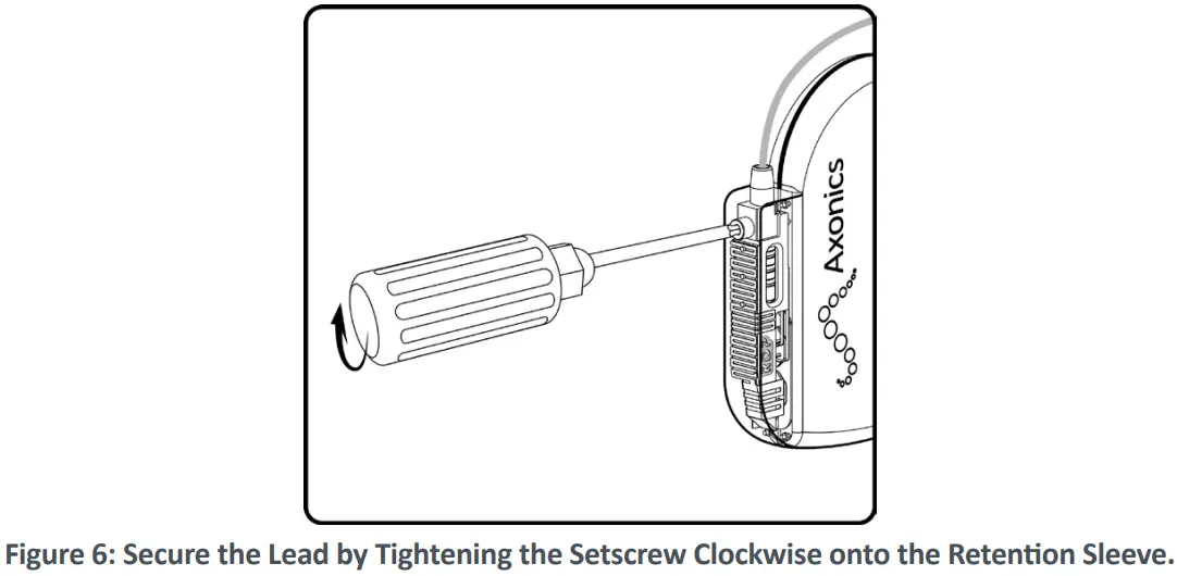 Axonics F15 Neurostimulator - Neurostimulator 3
