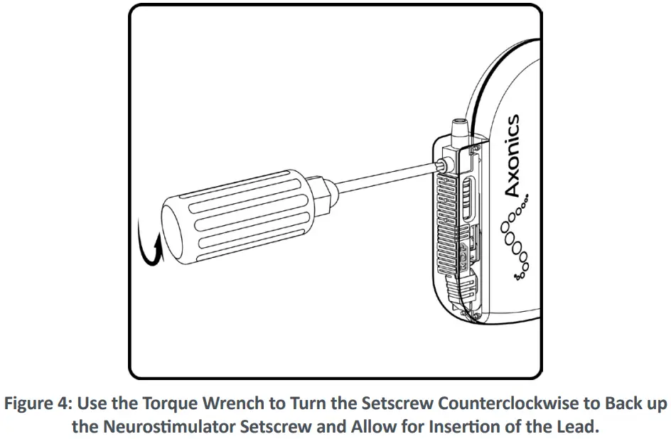 Axonics F15 Neurostimulator - Neurostimulator