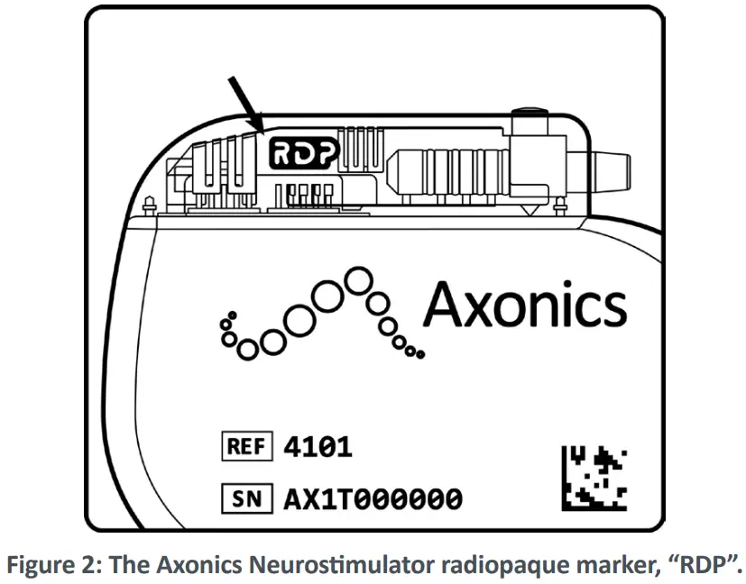 Axonics F15 Neurostimulator - X RAY IDENTIFICATION