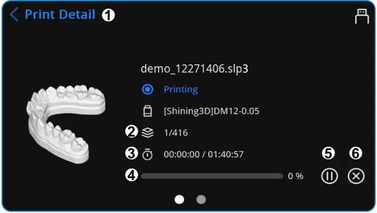 SHINING 3D Accufab D1 Dental 3D Printer - Print 16