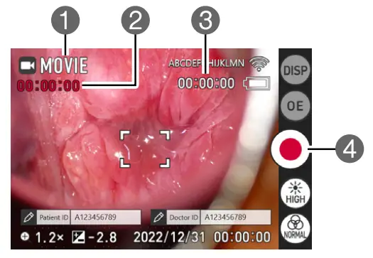 LCD Monitor Display Details and Switching Procedure