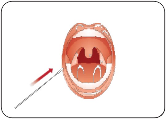 Attogene AU2033 SARS CoV 2 Influenza A and B Antigen Assay - fig 10