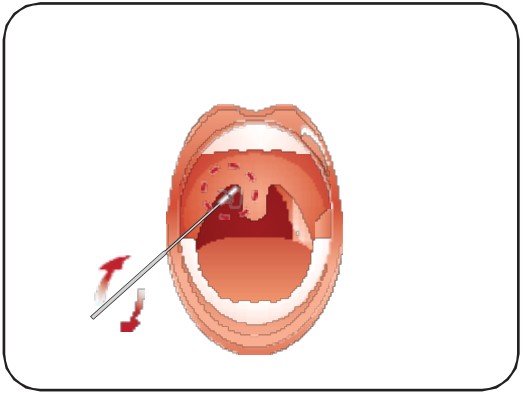 Attogene AU2033 SARS CoV 2 Influenza A and B Antigen Assay - fig 11