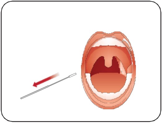 Attogene AU2033 SARS CoV 2 Influenza A and B Antigen Assay - fig 12
