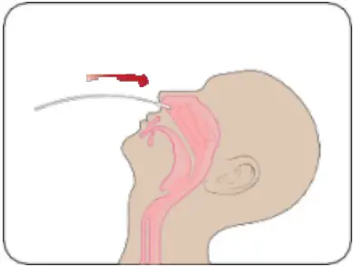 Attogene AU2033 SARS CoV 2 Influenza A and B Antigen Assay - fig 2