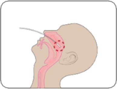 Attogene AU2033 SARS CoV 2 Influenza A and B Antigen Assay - fig 3
