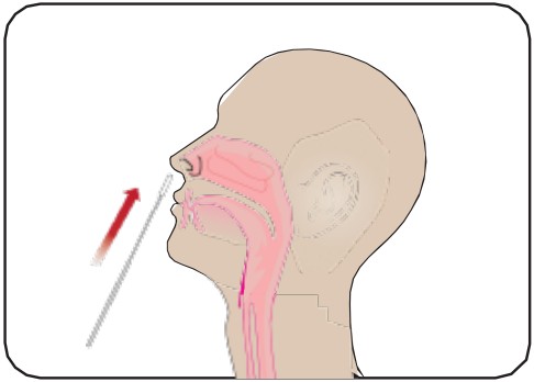 Attogene AU2033 SARS CoV 2 Influenza A and B Antigen Assay - fig 6