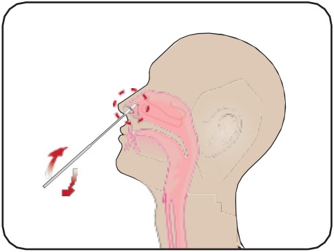 Attogene AU2033 SARS CoV 2 Influenza A and B Antigen Assay - fig 7