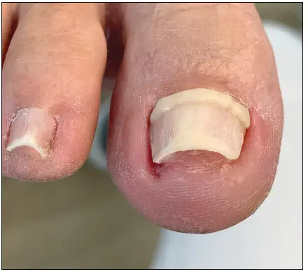 unguisan-BLUELIGHT-KOMPLETT-SET-Light-Starter-Set-FIG-1