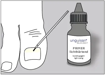 unguisan-BLUELIGHT-KOMPLETT-SET-Light-Starter-Set-FIG-3