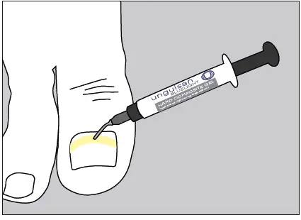 unguisan-BLUELIGHT-KOMPLETT-SET-Light-Starter-Set-FIG-4