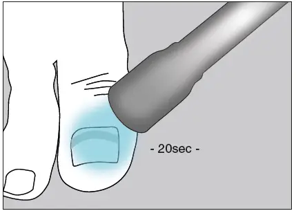 unguisan-BLUELIGHT-KOMPLETT-SET-Light-Starter-Set-FIG-5