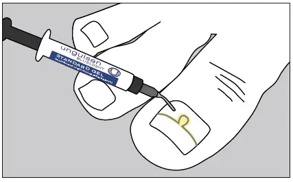 unguisan-BLUELIGHT-KOMPLETT-SET-Light-Starter-Set-FIG-6
