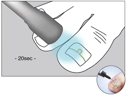 unguisan-BLUELIGHT-KOMPLETT-SET-Light-Starter-Set-FIG-7