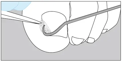 unguisan-BLUELIGHT-KOMPLETT-SET-Light-Starter-Set-FIG-9