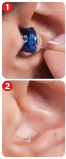 Lucid HEARING-INVISIBLE-IN-CANAL-96-Channel-Hearing-Aid-5