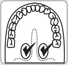 Kmart 20252 Complete Healthcare Kit - probe tip