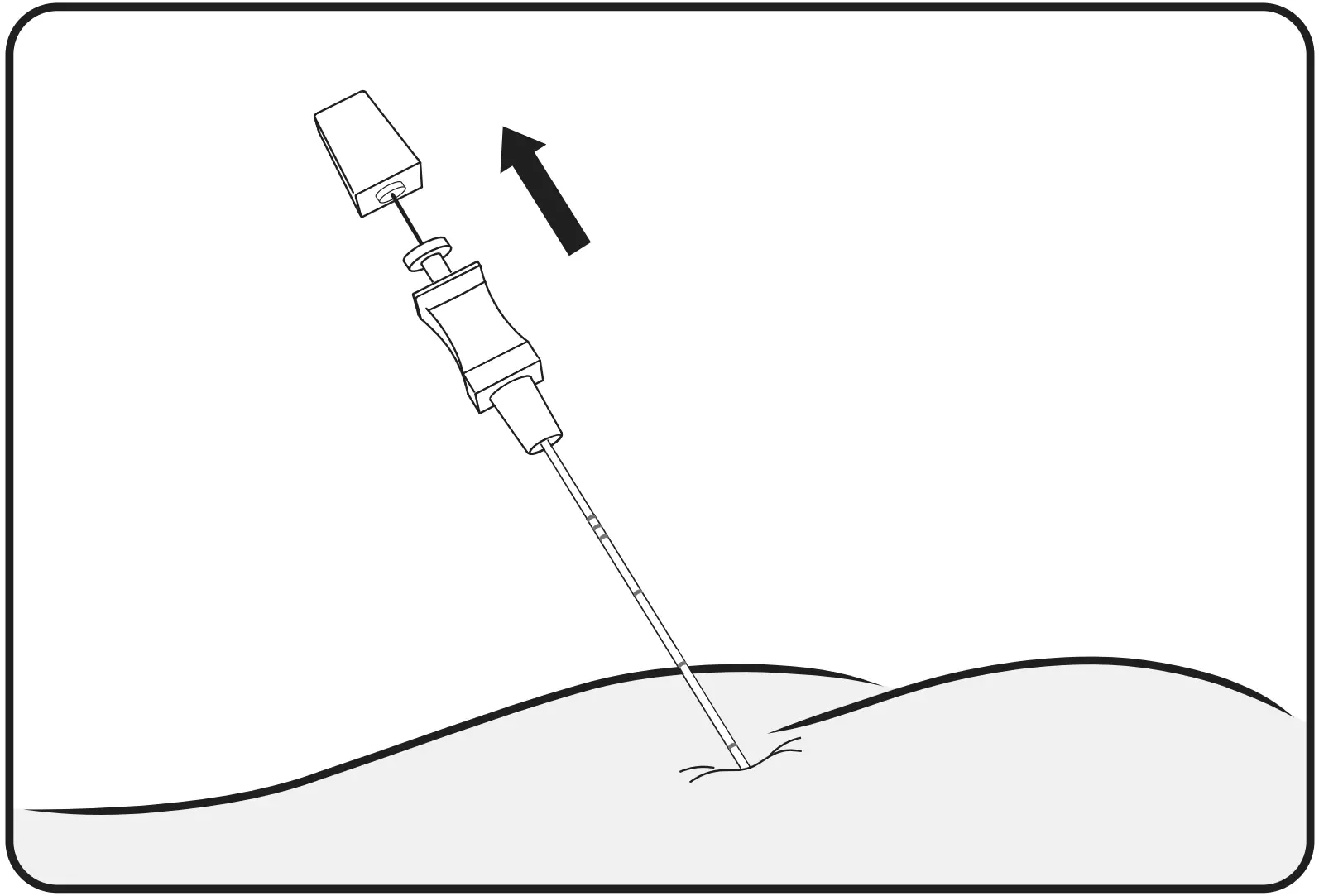 Tined lead placement