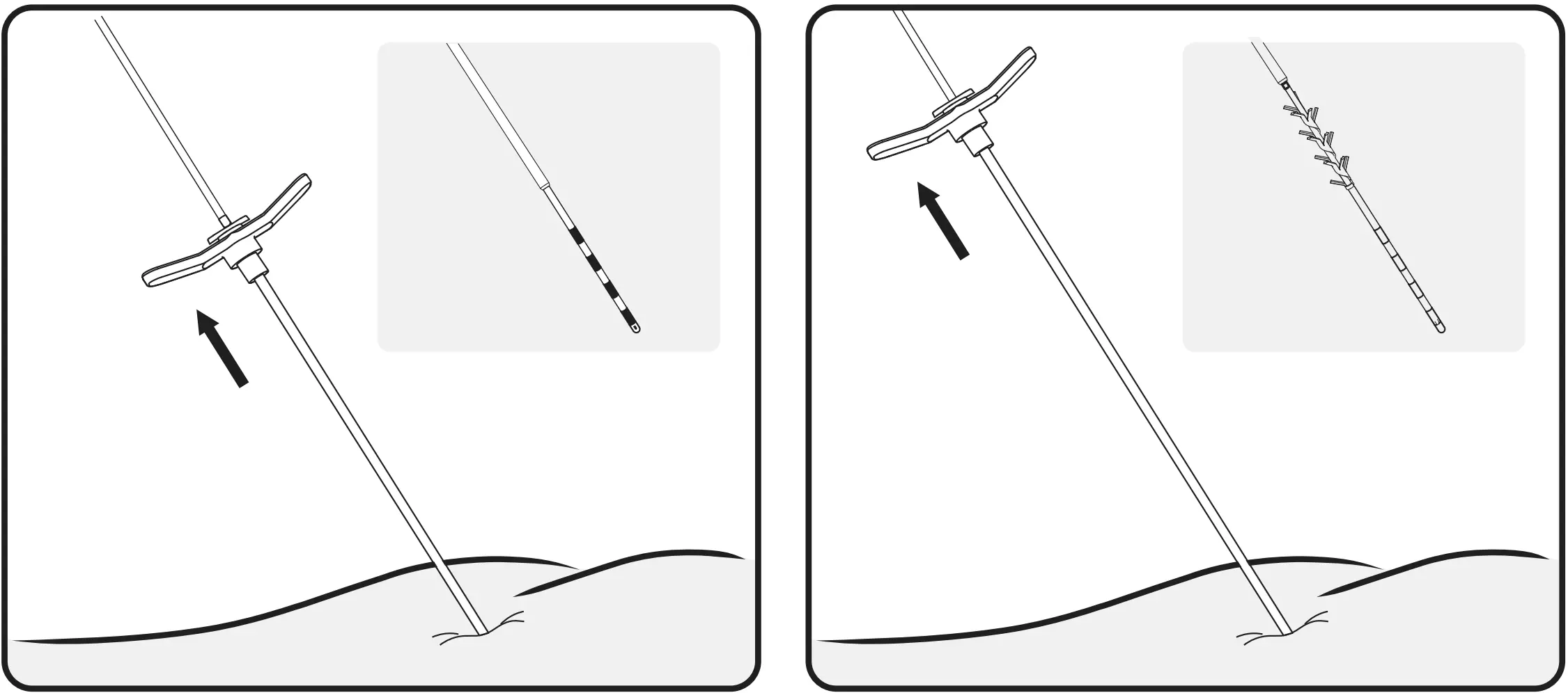 Grasp the tined lead