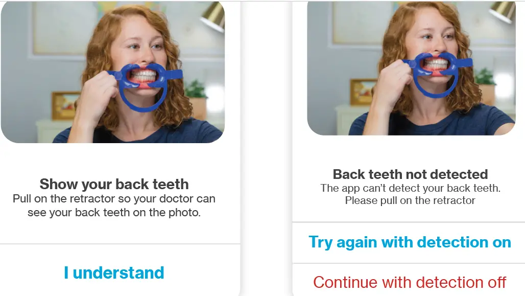 My-Invisalign-App-10