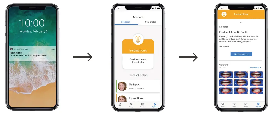 My-Invisalign-App-12