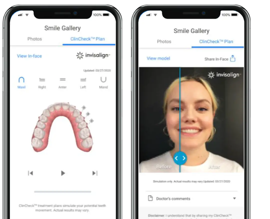 My-Invisalign-App-product-image