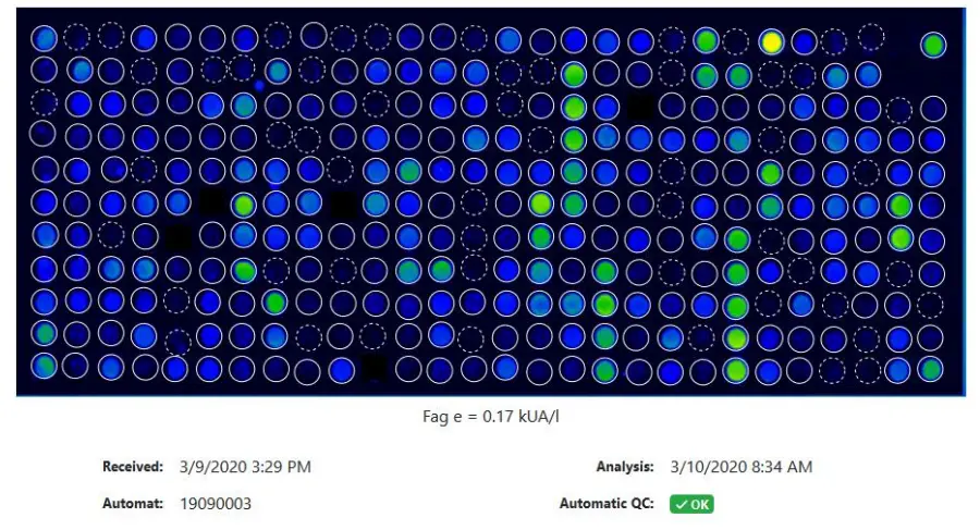 IMAGE PLORER Macro Array Diagnostics - CONTROL 1