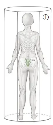 Axonics-110-0093-001rY-MRI-PatientAxonics-110-0093-001rY-MRI-Patient-fig-4