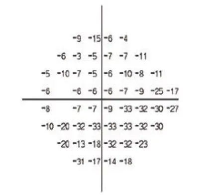 ZEISS-HFA3-Humphrey-Field-Analyzer-4