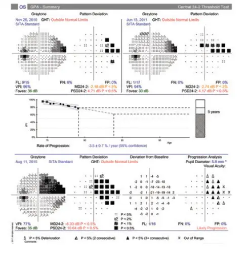 ZEISS-HFA3-Humphrey-Field-Analyzer-6