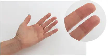 CNS SCP09 Capillary Blood Sample Collection Pack 36