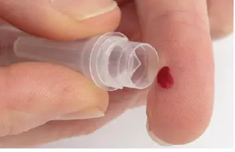 CNS SCP09 Capillary Blood Sample Collection Pack 41