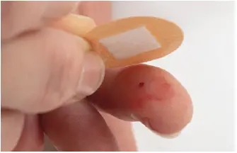 CNS SCP09 Capillary Blood Sample Collection Pack 45