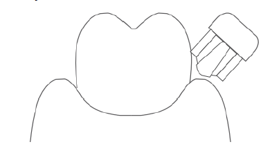 HOFFEN-AL-010125-Sonic-Toothbrush-fig-12