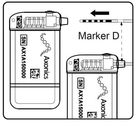 Axonics 5101 Neurostimulator - Fig 5
