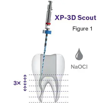 BRASSELER-USA-XP-3D-D-Shaper-and-Finisher-Endo-Files-fig-4