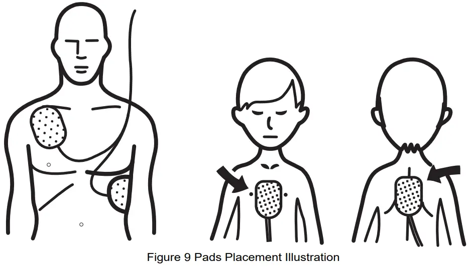JOUSING iAED S1T AED Trainer - Operation Steps