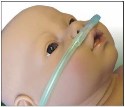 diamedica Portable Baby CPAP Instruction Manual - The product is supplied with RAM cannula