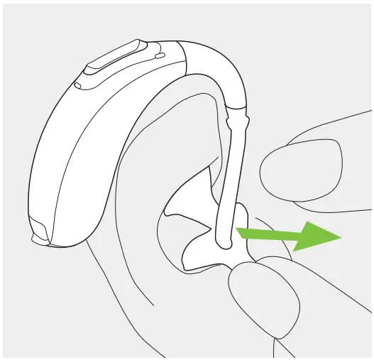 Removing the hearing aid