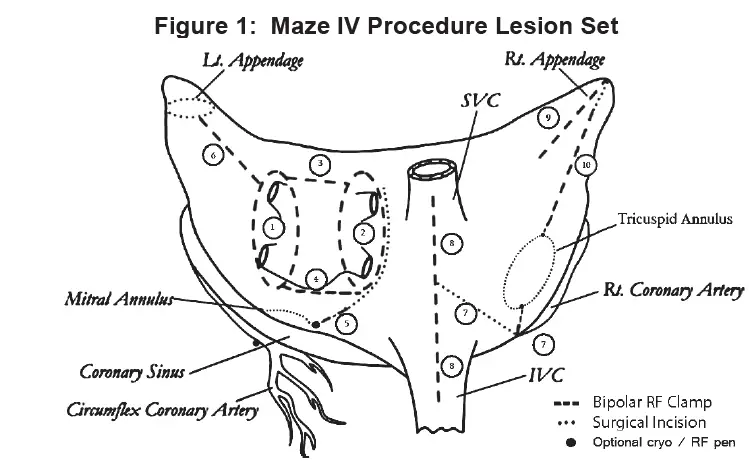AtriCure-ASB3-Synergy-System-03