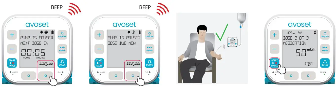 eitan-medical-avoset-Infusion-Pump-fig-13