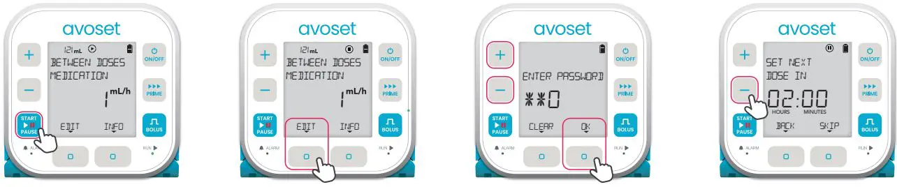 eitan-medical-avoset-Infusion-Pump-fig-15