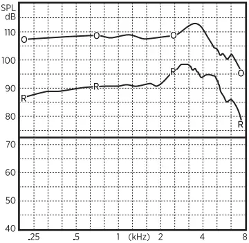 Lucid HEARING 2340 Open Fit Hearing Aid B12