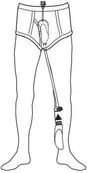 Attaching the device