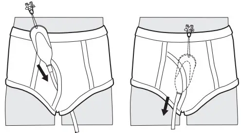 Attaching the device