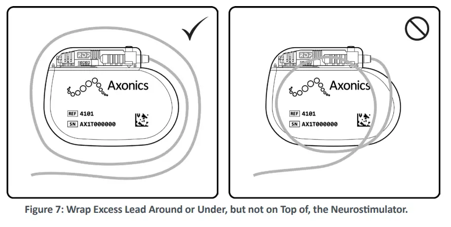 Axonics 4101 Neurostimulator - DEVICE 6