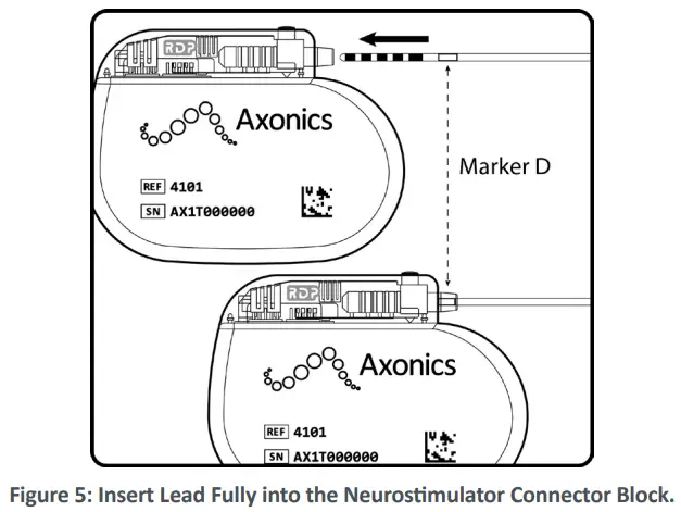 Axonics 4101 Neurostimulator - DEVICE4