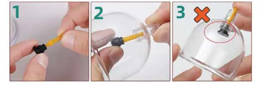 SURMOL-B0C2V2VZMV-Professional-Cupping-Set-FIG- (2)